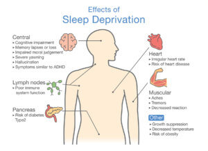 Diagram Of Effects Of Sleep Deprivation