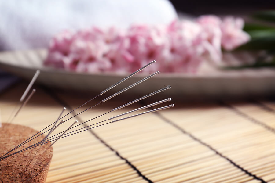 Acupuncture can help Relieve Menopausal Symptoms